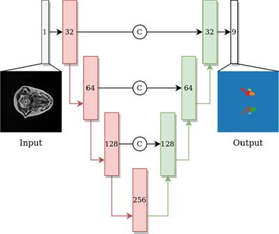 Segmentation stability of human head and neck cancer medical images for radiotherapy applications under de-identification conditions: Benchmarking data sharing and artificial intelligence use-cases